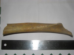 Human-Giant-BreitenwinnerBone1